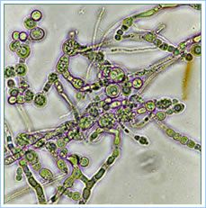 Mucor circinelloides